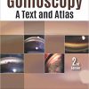 Gonioscopy: A Text and Atlas 2nd Edition-Original PDF