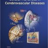 Molecular, Genetic, and Cellular Advances in Cerebrovascular Diseases-Original PDF