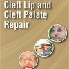 Art and Science of Cleft Lip and Cleft Palate Repair-Original PDF