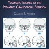 Diagnosis and Treatment of Traumatic Injuries to the Pediatric Craniofacial Skeleton-Original PDF