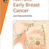 Fast Facts: Early Breast Cancer -Original PDF