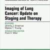 Lung Cancer, An Issue of Radiologic Clinics of North America, 1e (The Clinics: Radiology)-Original PDF