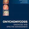 Onychomycosis: Diagnosis and Effective Management-Original PDF