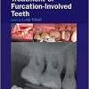 Diagnosis and Treatment of Furcation-Involved Teeth-EPUB