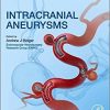 Intracranial Aneurysms-Original PDF