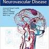 Decision Making in Neurovascular Disease-EPUB