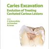 Caries Excavation: Evolution of Treating Cavitated Carious Lesions (Monographs in Oral Science, Vol. 27)-Original PDF