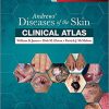 Andrews’ Diseases of the Skin Clinical Atlas, 1e-Original PDF