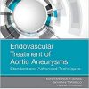Endovascular Treatment of Aortic Aneurysms: Standard and Advanced Techniques, 1e-Original PDF