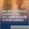 Implante quir£rgico de dispositivos para la monitorizaci¢n del ritmo card¡aco (Spanish)-Original PDF