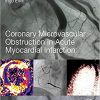 Coronary Microvascular Obstruction in Acute Myocardial Infarction: From Mechanisms to Treatment-Original PDF