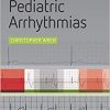 Concise Guide to Pediatric Arrhythmias-Original PDF