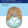 Meningiomas of the Skull Base: Treatment Nuances in Contemporary Neurosurgery-Original PDF