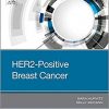 HER2-Positive Breast Cancer-EPUB