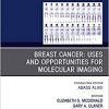 Breast Cancer: Uses and Opportunities for Molecular Imaging, An Issue of PET Clinics (The Clinics: Radiology)-Original PDF