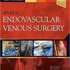 Atlas of Endovascular Venous Surgery 2nd Edition-EPUB