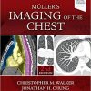 Muller’s Imaging of the Chest: Expert Radiology Series 2nd Edition-Original PDF