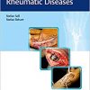 Surgery for Rheumatic Diseases-Original PDF