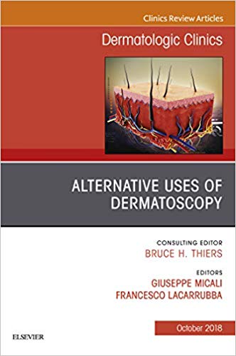 Alternative Uses of Dermatoscopy, An Issue of Dermatologic Clinics (The Clinics: Dermatology)-Original PDF