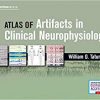 Artifacts in Clinical Neurophysiology-Original PDF