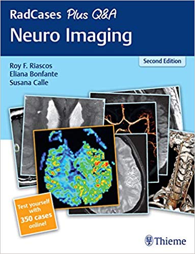 RadCases Plus Q&A Neuro Imaging 2nd Edition-High Quality PDF