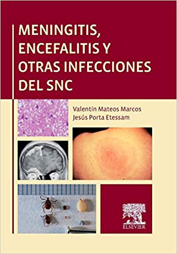Meningitis (Spanish)-Original PDF