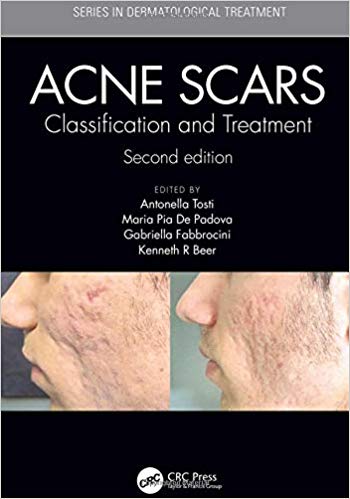 Acne Scars: Classification and Treatment, Second Edition (Series in Dermatological Treatment)-Original PDF