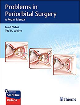 Problems in Periorbital Surgery: A Repair Manual-Original PDF