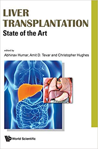 Liver Transplantation: State of the Art-Original PDF