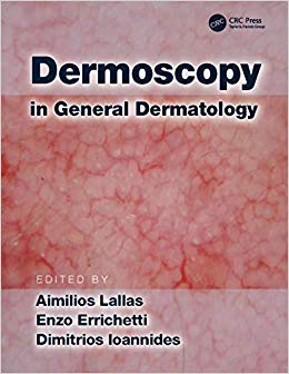 Dermoscopy in General Dermatology-Original PDF