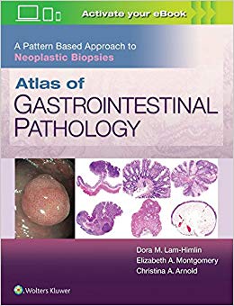 Atlas of Gastrointestinal Pathology: A Pattern Based Approach to Neoplastic Biopsies-EPUB