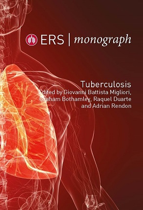 Tuberculosis (ERS Monograph)-Original PDF
