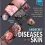 Andrews’ Diseases of the Skin: Clinical Dermatology 13th Edition-Original PDF+Videos