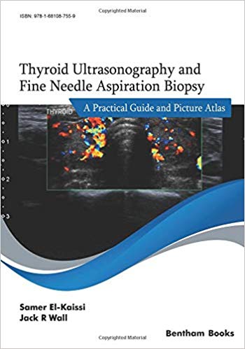 Thyroid Ultrasonography and Fine Needle Aspiration Biopsy: A Practical Guide and Picture Atlas-Original PDF