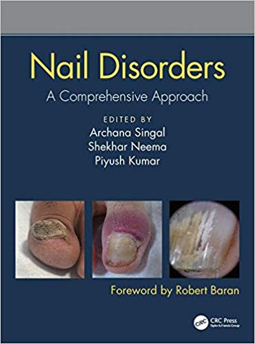 Nail Disorders: A Comprehensive Approach-Original PDF