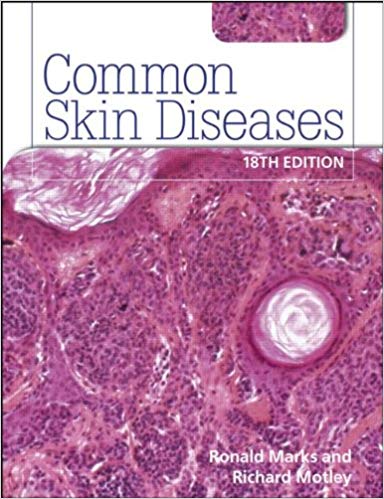 Common Skin Diseases 18th edition: ISE Version-Original PDF