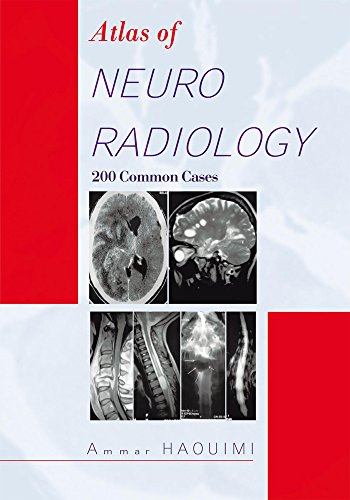 Atlas of Neuroradiology: 200 Common Cases-EPUB+MOBI+PDF
