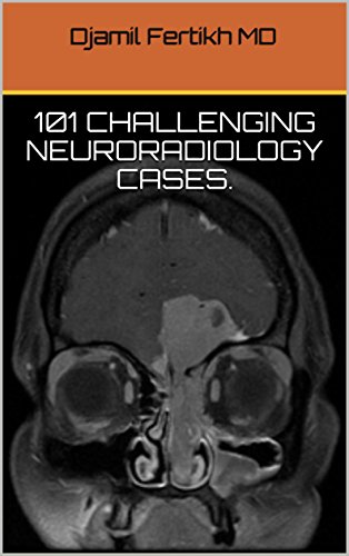 101 Challenging Neuroradiology Cases-EPUB