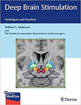 Deep Brain Stimulation: Techniques and Practices-High Quality PDF