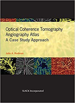 Optical Coherence Tomography Angiography Atlas: A Case Study Approach-Original PDF