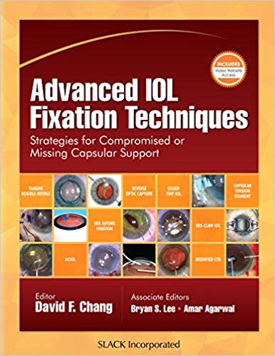 Advanced IOL Fixation Techniques: Strategies for Compromised or Missing Capsular Support-Original PDF