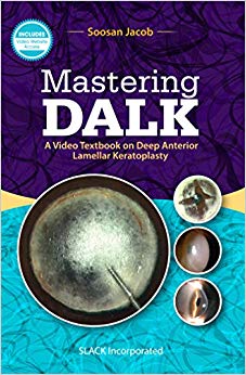 Mastering DALK: A Video Textbook on Deep Anterior Lamellar Keratoplasty-Original PDF