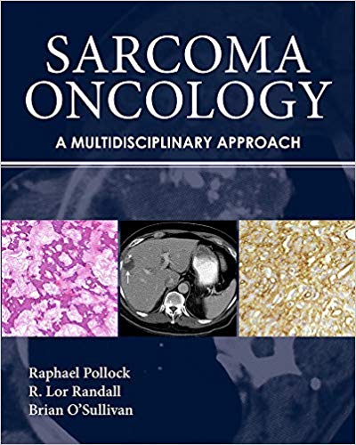 Sarcoma Oncology: A Multidisciplinary Approach-Original PDF