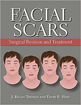 Facial Scars: Surgical Revision and Treatment-Original PDF