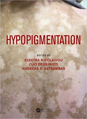 Hypopigmentation-Original PDF