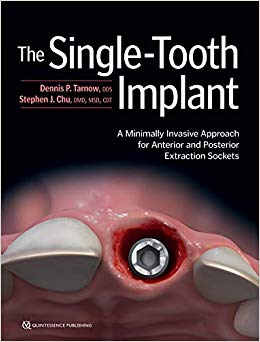 The Single-Tooth Implant: A Minimally Invasive Approach for Anterior and Posterior Extraction Sockets-Original PDF
