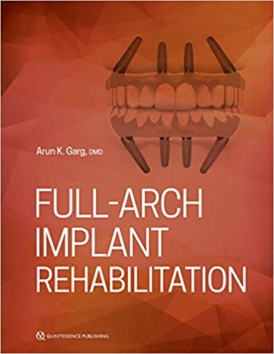 Full-Arch Implant Rehabilitation-Original PDF