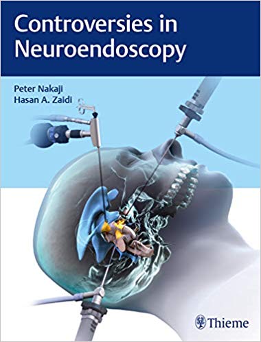 Controversies in Neuroendoscopy-EPUB
