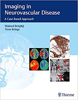 Imaging in Neurovascular Disease: A Case-Based Approach-Original PDF