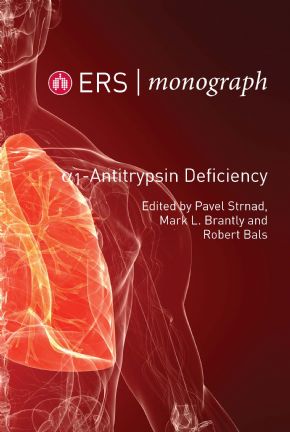 ERS Monograph 85: Alpha-1-Antitrypsin Defieciency-Original PDF